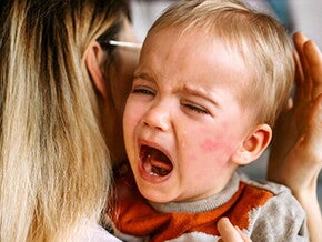 玫瑰疹症狀有什麼?寶寶傳染玫瑰疹發燒、拉肚子怎麼照顧 玫瑰疹症狀有什麼?寶寶傳染玫瑰疹發燒、拉肚子怎麼照顧